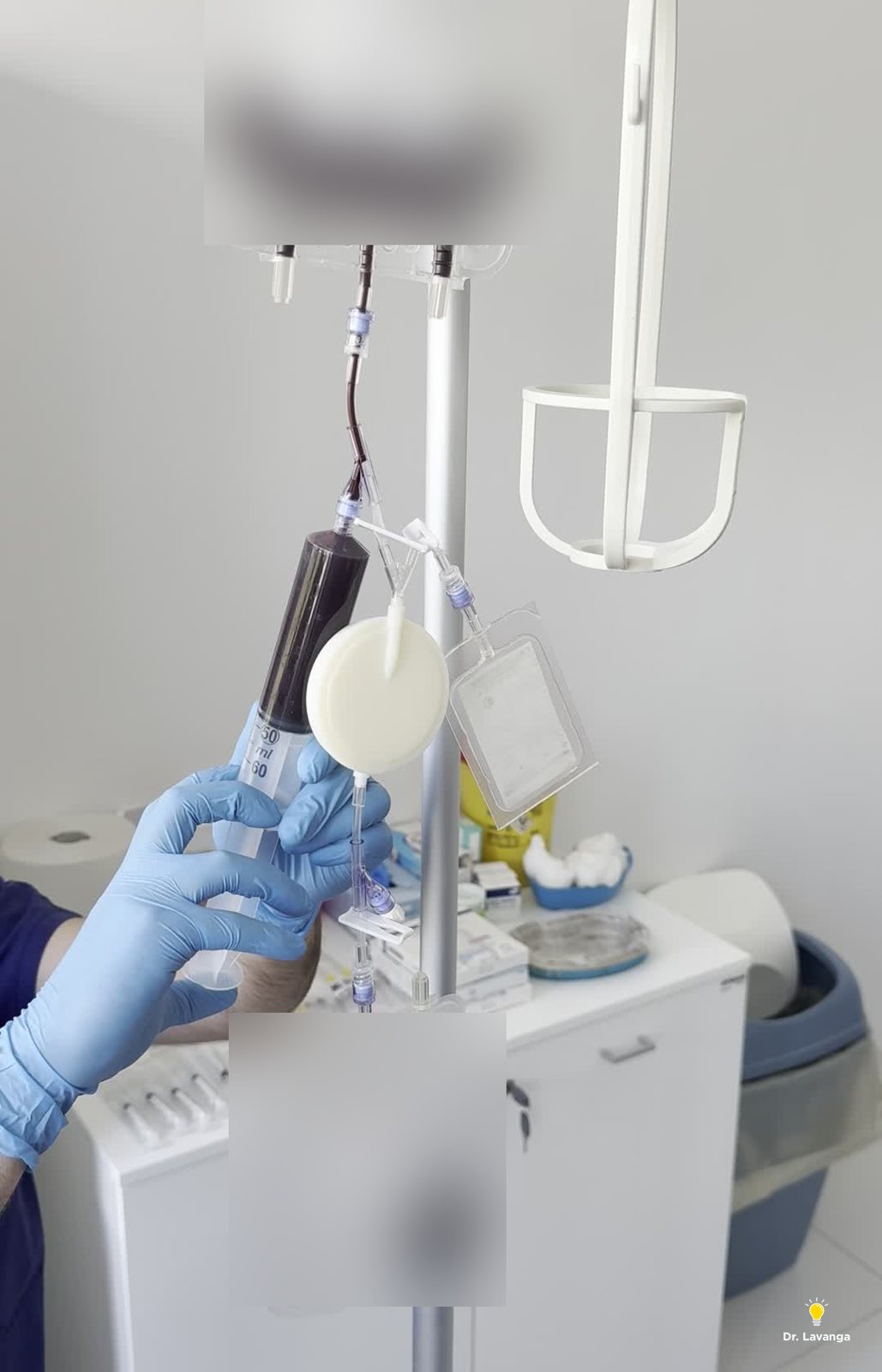 Sacca e filtro dedicato in cui il sangue viene filtrato per raccogliere i monociti