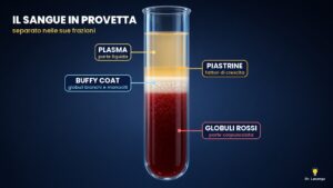 Infiltrazioni con monociti-macrofagi: come funzionano e quando sceglierle