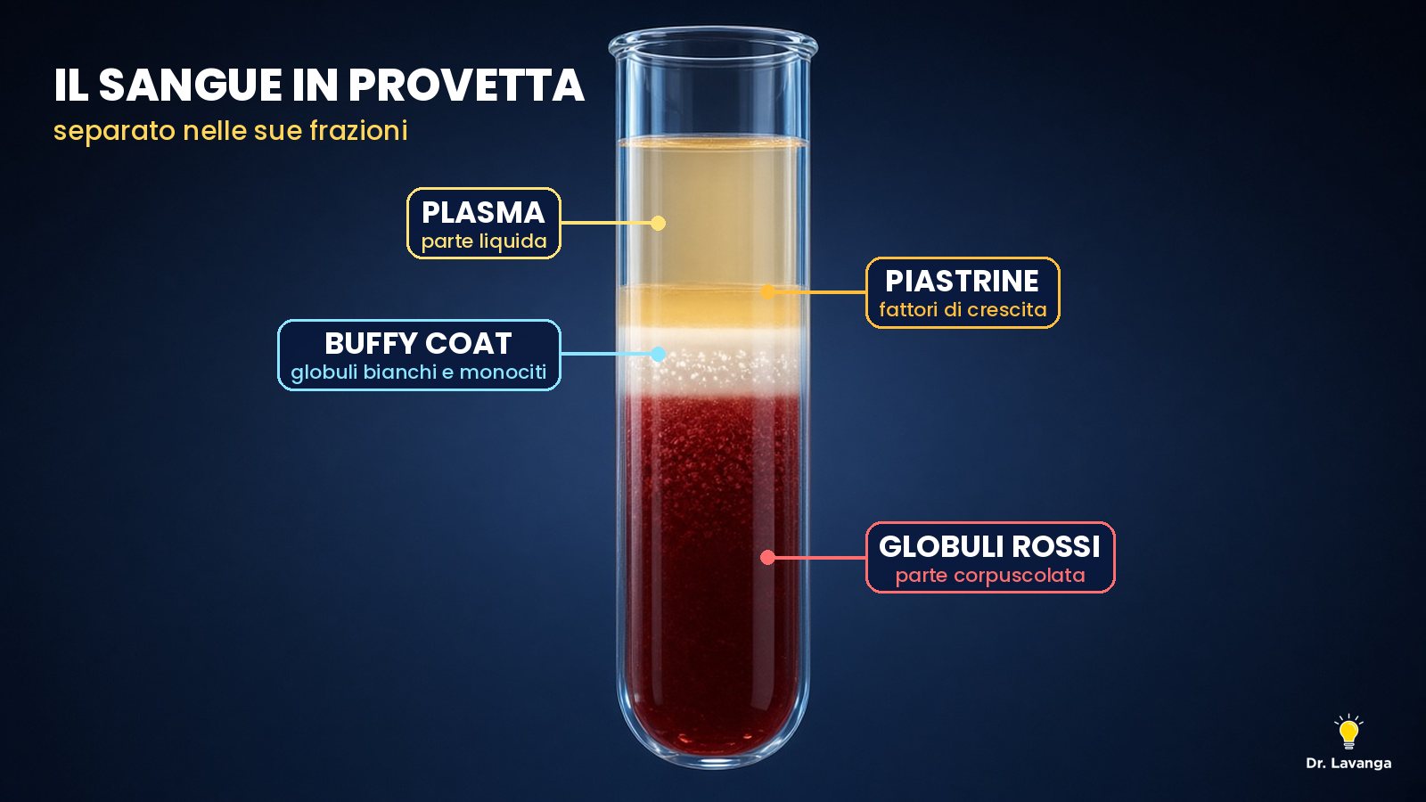 Rendering 3D di una provetta di sangue separata in plasma, piastrine, buffy coat con i monociti e globuli rossi